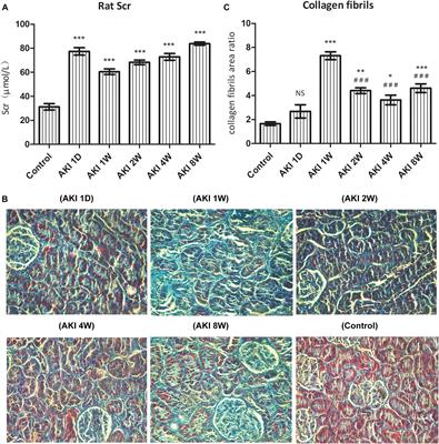 Critical Role of Cysteine-Rich Protein 61 in Mediating the Activation of Renal Fibroblasts